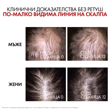 Vichy Dercos Aminexil Clinical R.E.G.E.N Booster Серум за обновяване на косата 90 мл