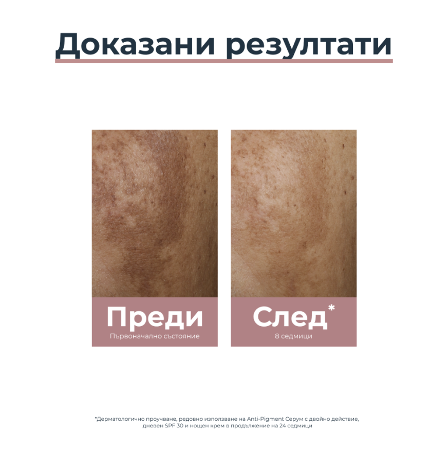 Eucerin ANTI-PIGMENT Серум с двойно действие, 30 мл