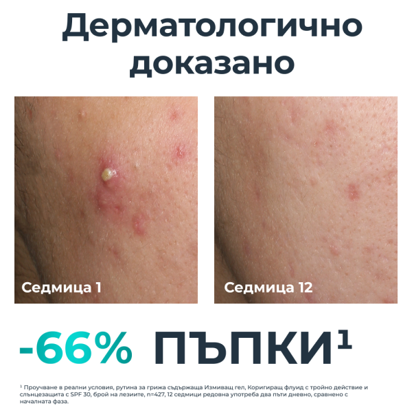Eucerin DERMOPURE CLINICAL Коригиращ флуид с тройно действие+ Eucerin Oil Control Слънцезащитен гел-крем за лице за мазна кожа