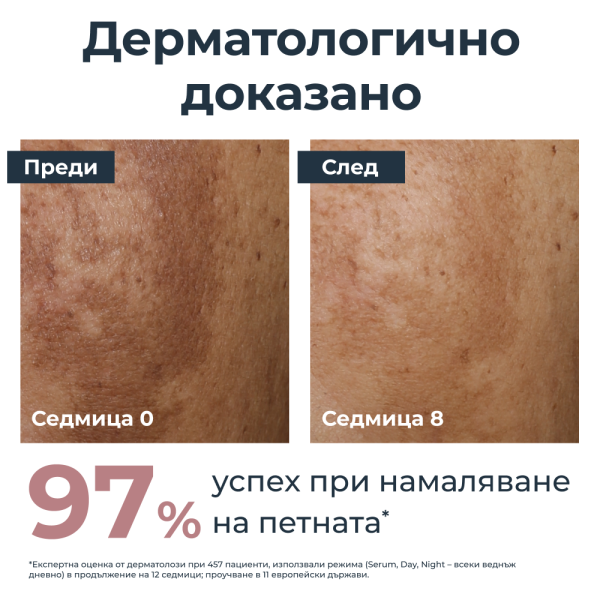 Eucerin® Комплект Anti-Pigment Измиващ гел, 200мл + Дневен крем SPF30, 50мл